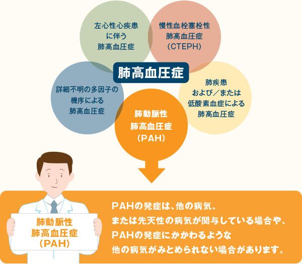 肺動脈性肺高血圧症（PAH）とは